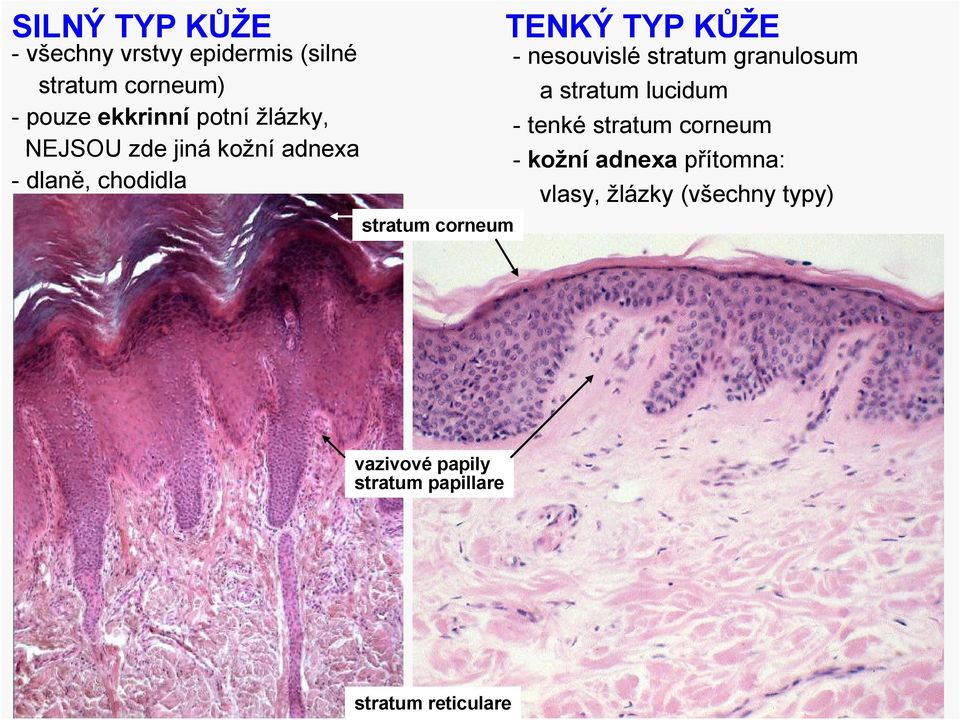 nesouvislé stratum granulosum a stratum lucidum - tenké stratum corneum - kožní adnexa