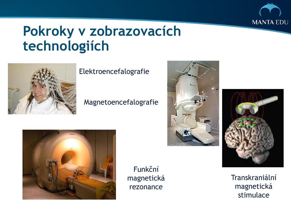 Magnetoencefalografie Funkční