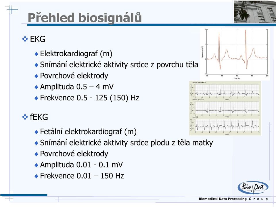 5-125 (150) Hz fekg Fetální elektrokardiograf (m) Snímání elektrické aktivity