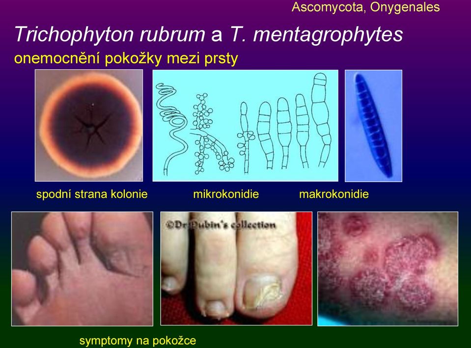 mentagrophytes onemocnění pokožky mezi