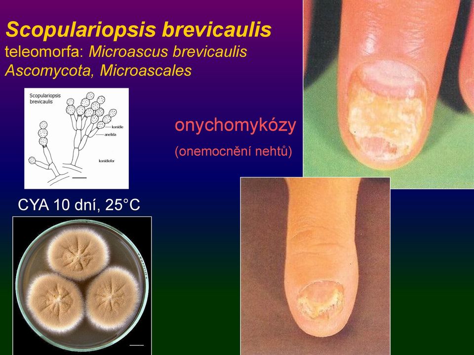 brevicaulis Ascomycota,