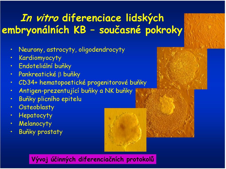 hematopoetické progenitorové buňky Antigen-prezentující buňky a NK buňky Buňky