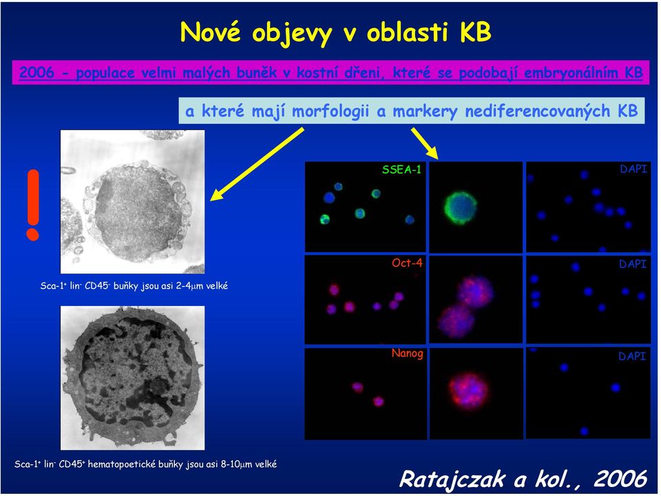 SSEA-1 DAPI Sca-1 + lin - CD45 - buňky jsou asi 2-4µm velké Oct-4 DAPI Nanog DAPI