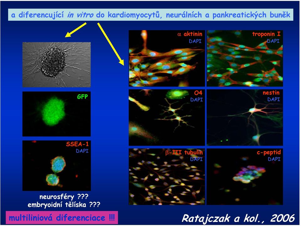 nestin DAPI SSEA-1 DAPI β-iii tubulin DAPI c-peptid DAPI