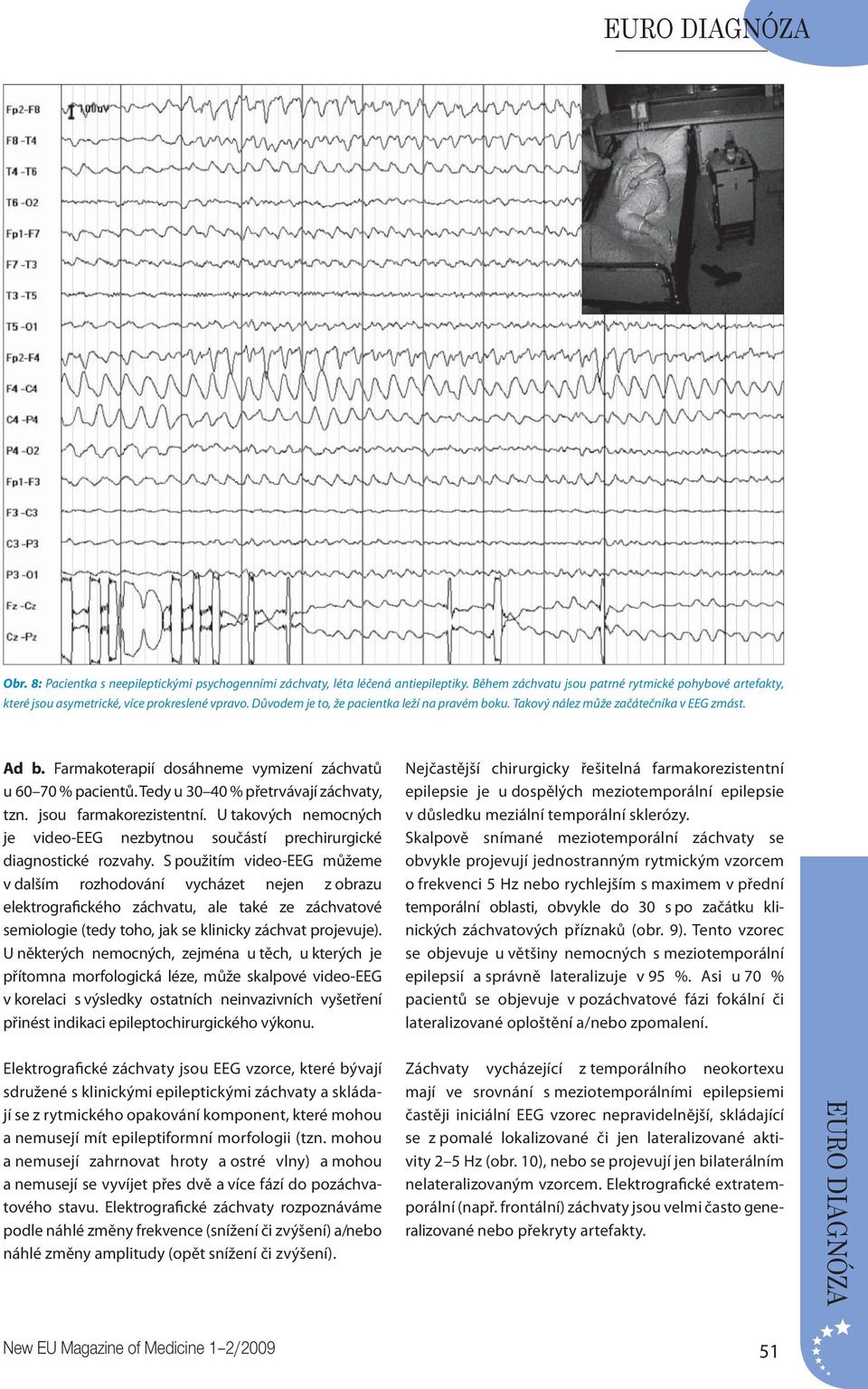 Tedy u 30 40 % přetrvávají záchvaty, tzn. jsou farmakorezistentní. U takových nemocných je video-eeg nezbytnou součástí prechirurgické diagnostické rozvahy.