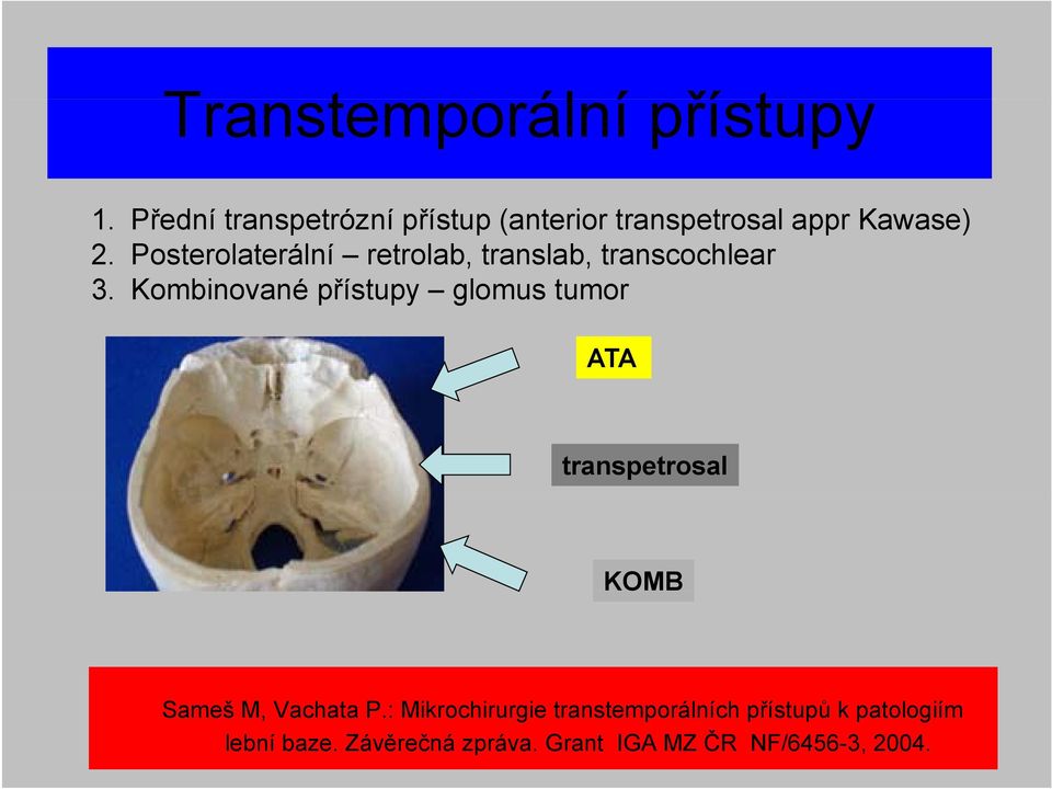 Posterolaterální retrolab, translab, transcochlear 3.