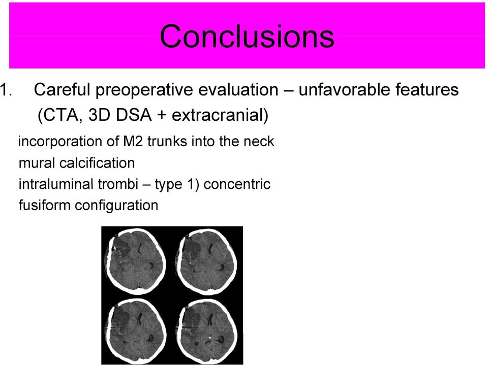 (CTA, 3D DSA + extracranial) incorporation of M2