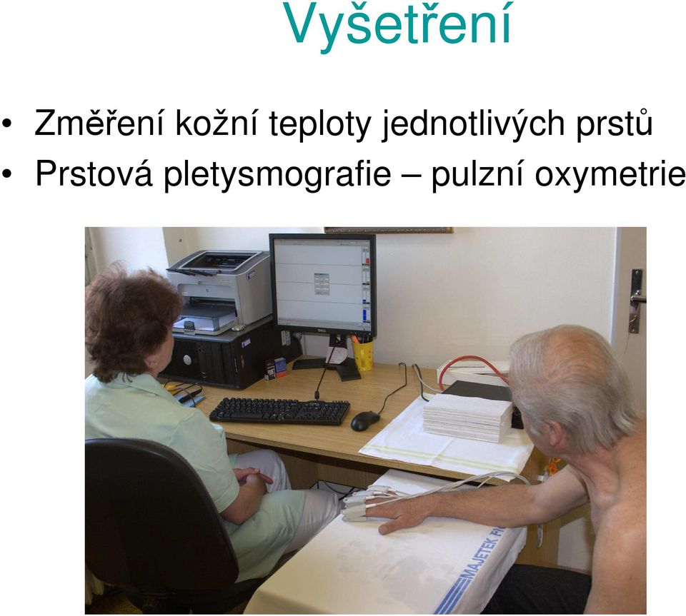 jednotlivých prstů