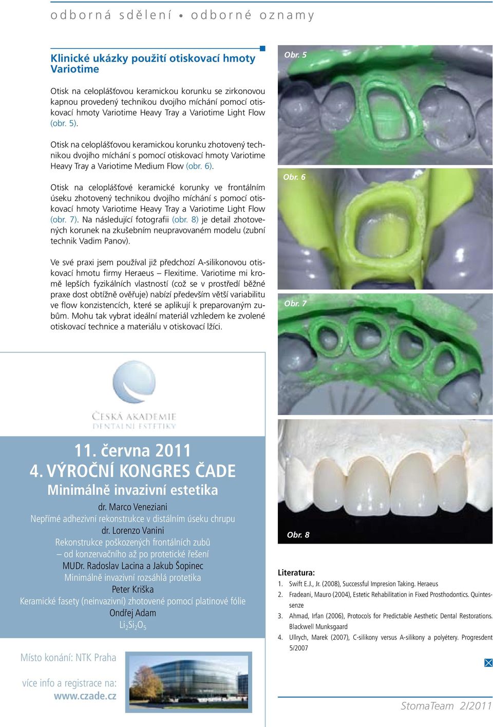 Otisk na celoplášťovou keramickou korunku zhotovený technikou dvojího míchání s pomocí otiskovací hmoty Variotime Heavy Tray a Variotime Medium Flow (obr. 6).
