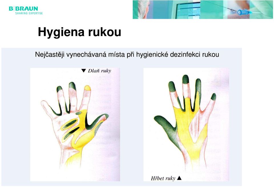 vaná místa při p i