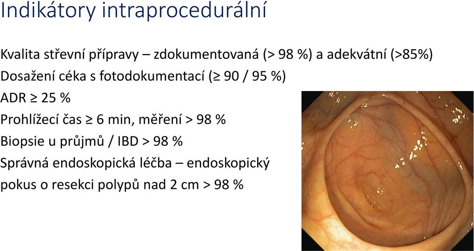 25 % Prohlížecí čas 6 min, měření > 98 % Biopsie u průjmů / IBD > 98 %