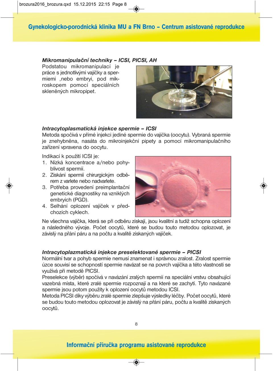 mikropipet. Intracytoplasmatická injekce spermie ICSI Metoda spočívá v přímé injekci jediné spermie do vajíčka (oocytu).