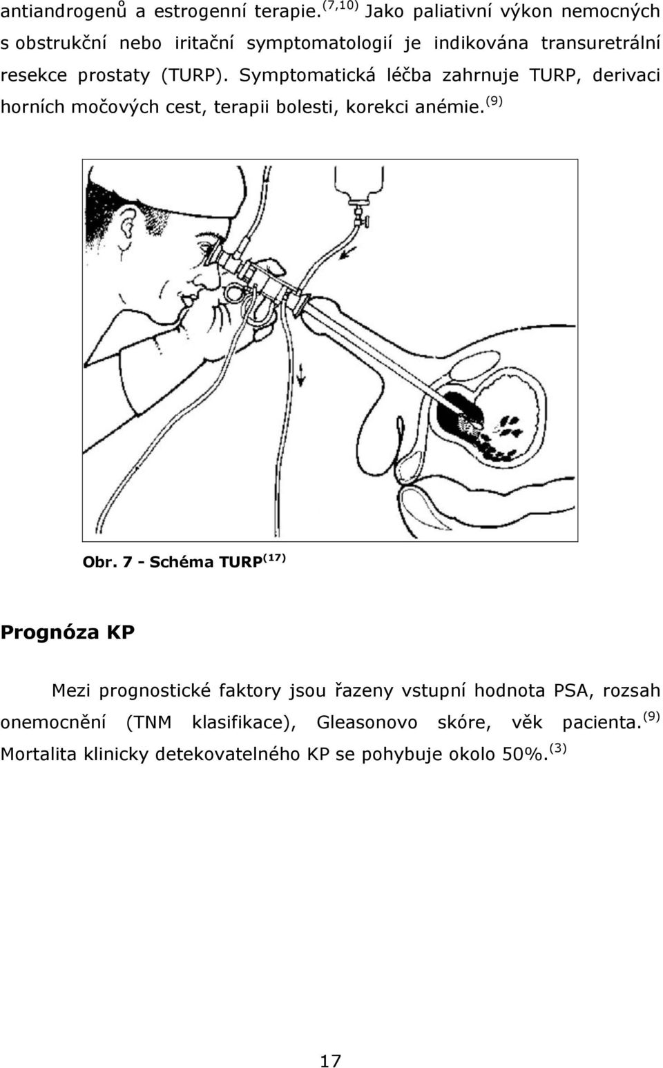 (TURP). Symptomatická léčba zahrnuje TURP, derivaci horních močových cest, terapii bolesti, korekci anémie. (9) Obr.