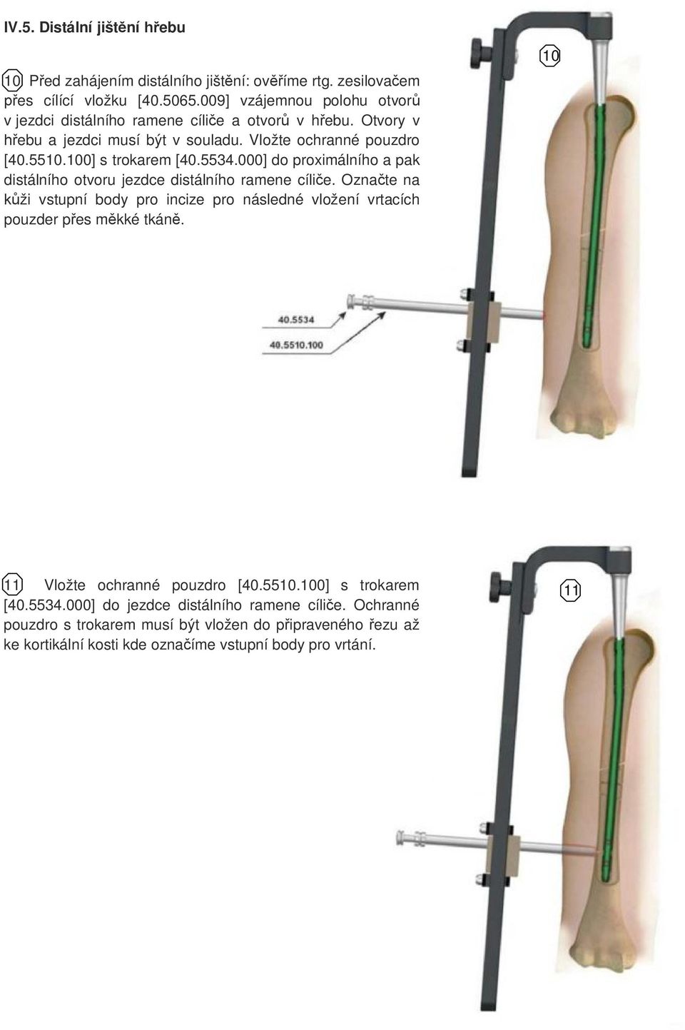 5534.000] do proximálního a pak distálního otvoru jezdce distálního ramene cíliče. Označte na kůži vstupní body pro incize pro následné vložení vrtacích pouzder přes měkké tkáně.