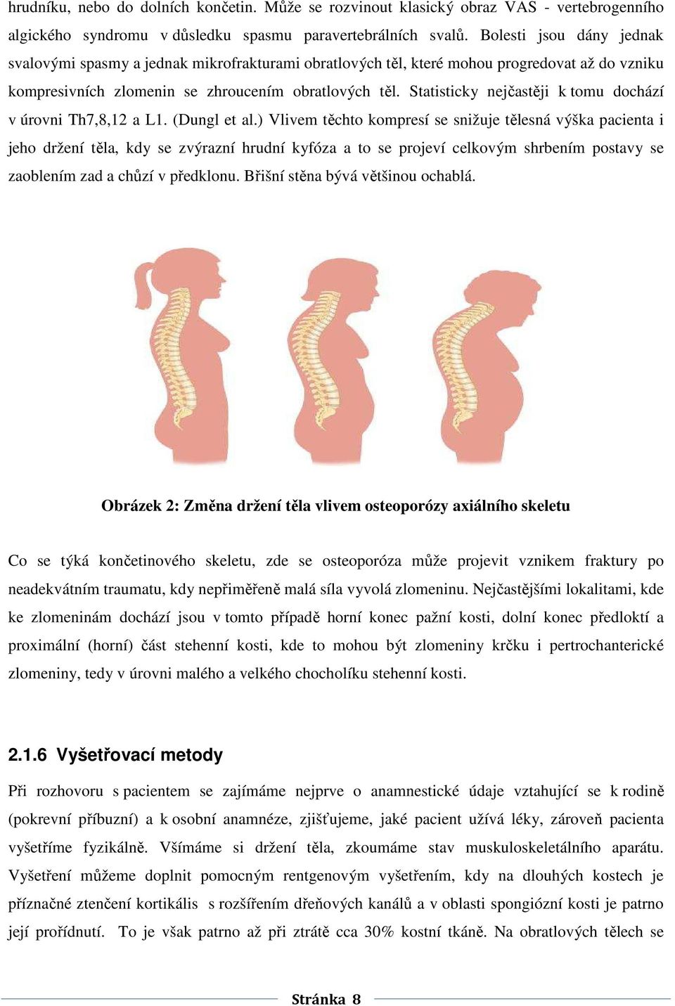Statisticky nejčastěji k tomu dochází v úrovni Th7,8,12 a L1. (Dungl et al.
