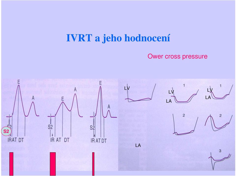 cross pressure