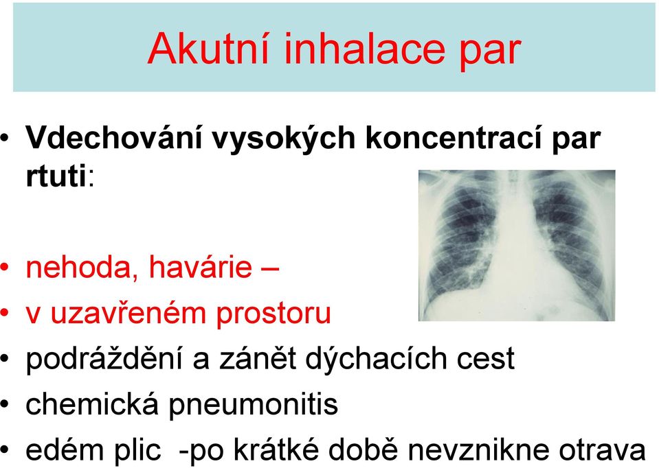 uzavřeném prostoru podráždění a zánět dýchacích