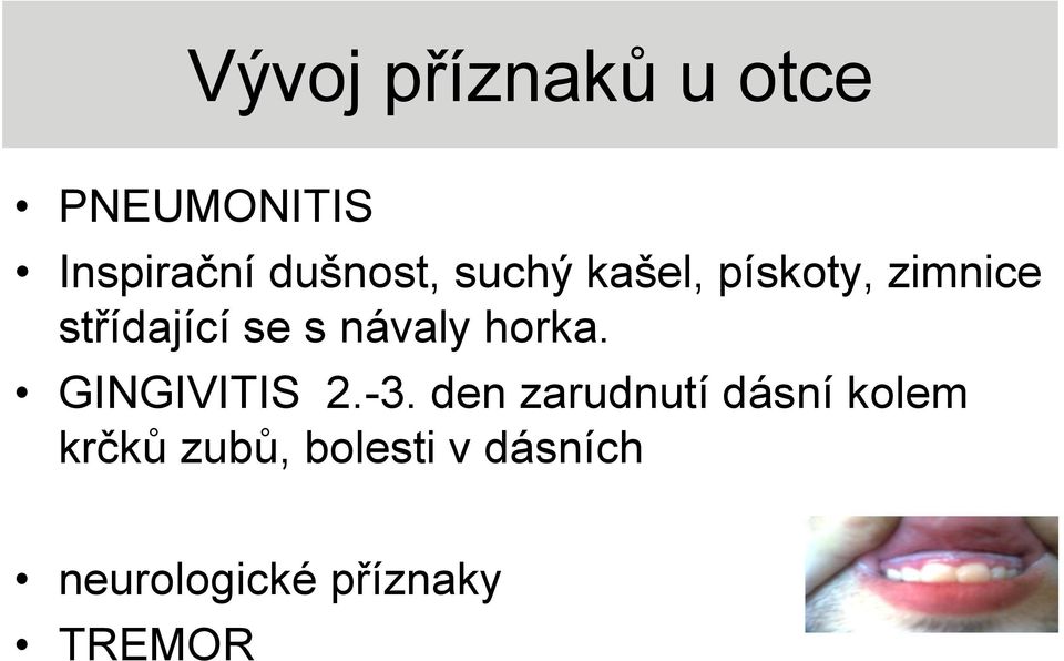 horka. GINGIVITIS 2.-3.