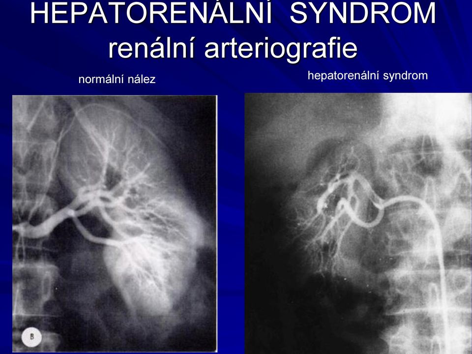 arteriografie