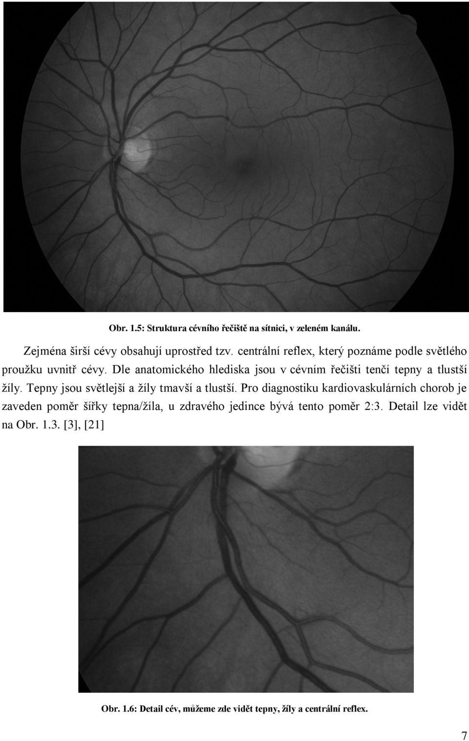 Dle anatomického hlediska jsou v cévním řečišti tenčí tepny a tlustší žíly. Tepny jsou světlejší a žíly tmavší a tlustší.