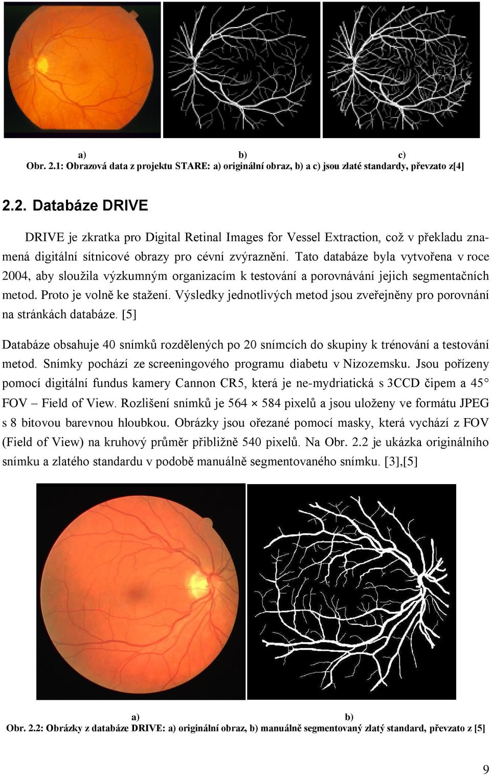 Výsledky jednotlivých metod jsou zveřejněny pro porovnání na stránkách databáze. [5] Databáze obsahuje 40 snímků rozdělených po 20 snímcích do skupiny k trénování a testování metod.