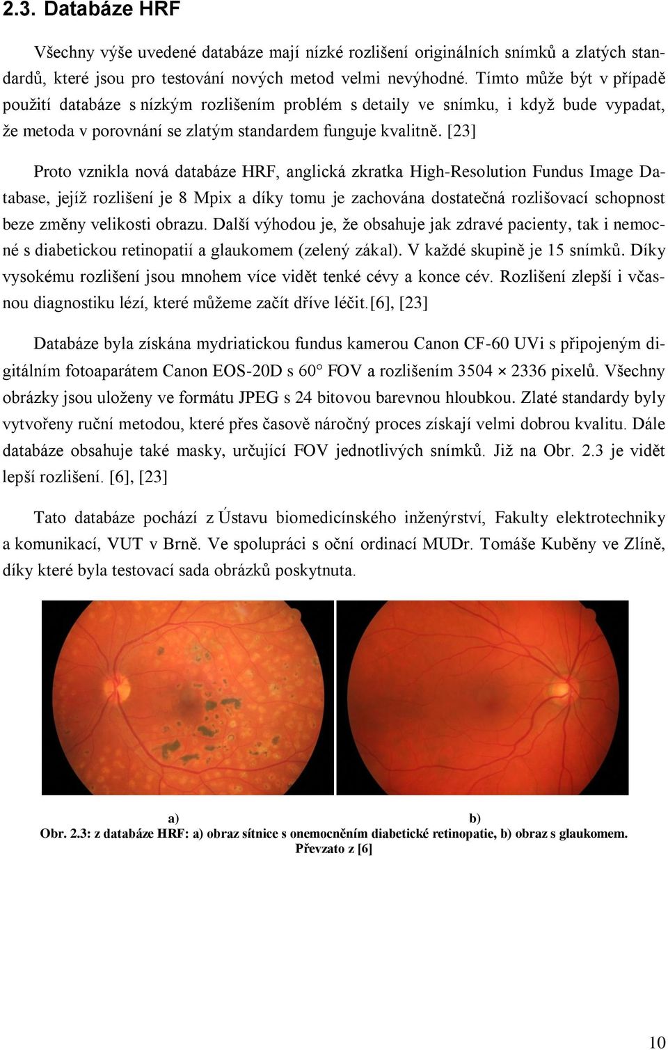 [23] Proto vznikla nová databáze HRF, anglická zkratka High-Resolution Fundus Image Database, jejíž rozlišení je 8 Mpix a díky tomu je zachována dostatečná rozlišovací schopnost beze změny velikosti