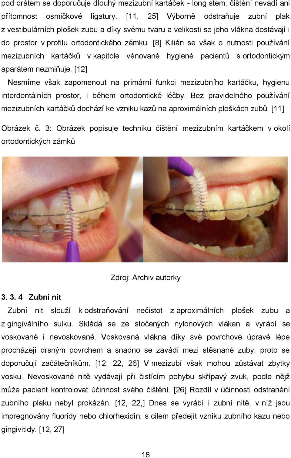 [8] Kilián se však o nutnosti používání mezizubních kartáčků v kapitole věnované hygieně pacientů s ortodontickým aparátem nezmiňuje.