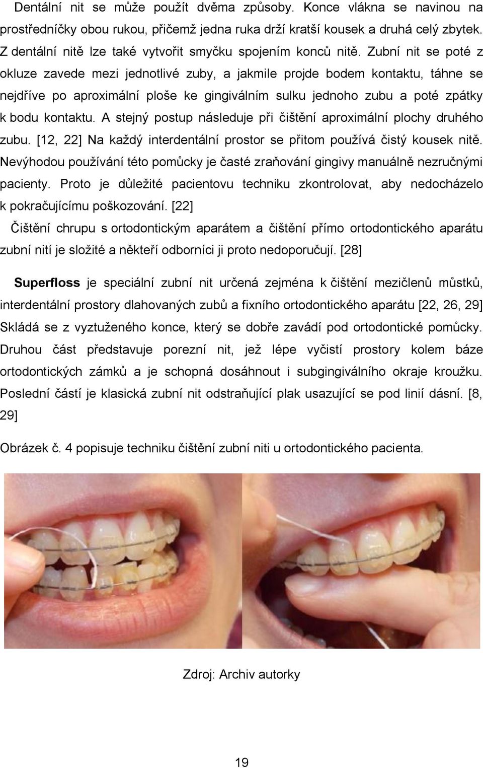 Zubní nit se poté z okluze zavede mezi jednotlivé zuby, a jakmile projde bodem kontaktu, táhne se nejdříve po aproximální ploše ke gingiválním sulku jednoho zubu a poté zpátky k bodu kontaktu.