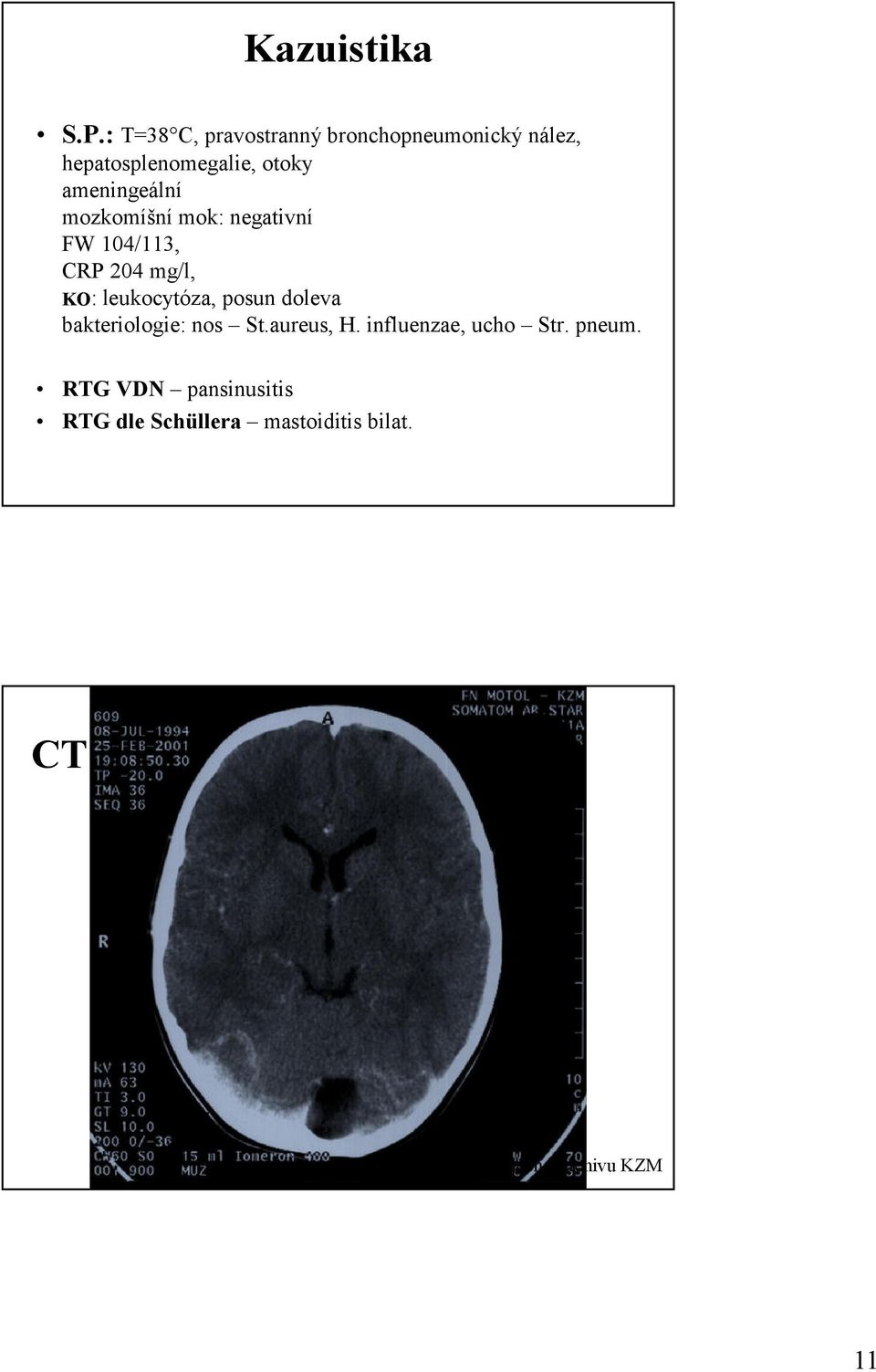 ameningeální mozkomíšní mok: negativní FW 104/113, CRP 204 mg/l, KO: leukocytóza,