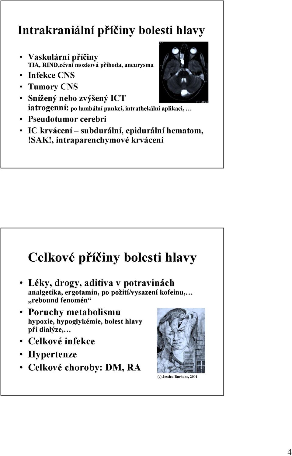 , intraparenchymové krvácení Celkové příčiny bolesti hlavy Léky, drogy, aditiva v potravinách analgetika, ergotamin, po požití/vysazení kofeinu,