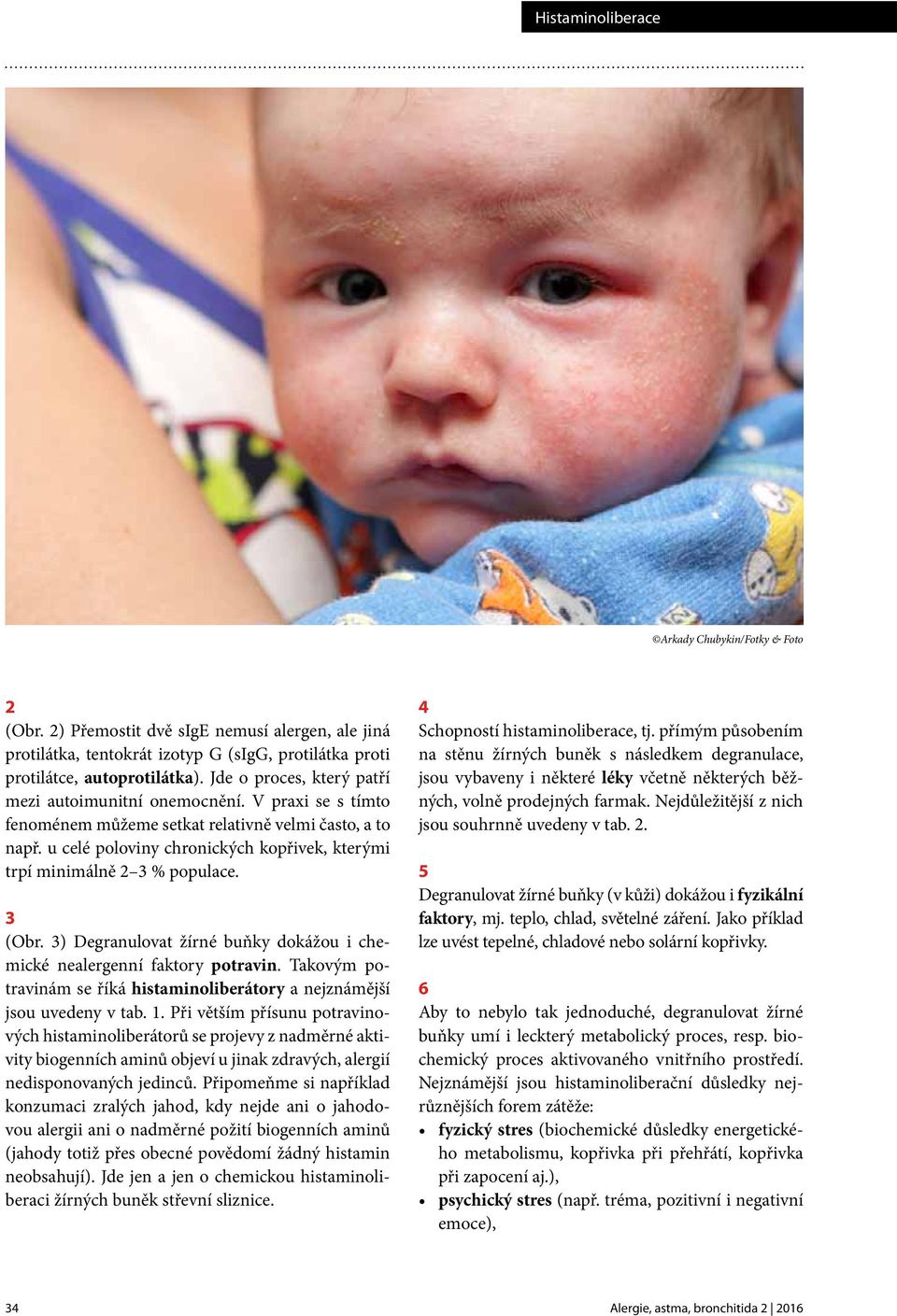 u celé poloviny chronických kopřivek, kterými trpí minimálně 2 3 % populace. 3 (Obr. 3) Degranulovat žírné buňky dokážou i chemické nealergenní faktory potravin.