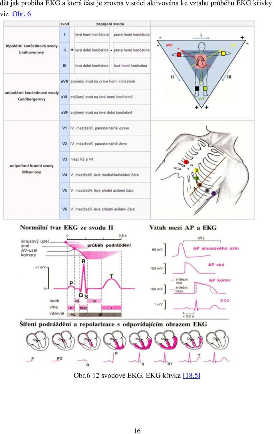 průběhu EKG křivky. viz Obr. 6 Obr.