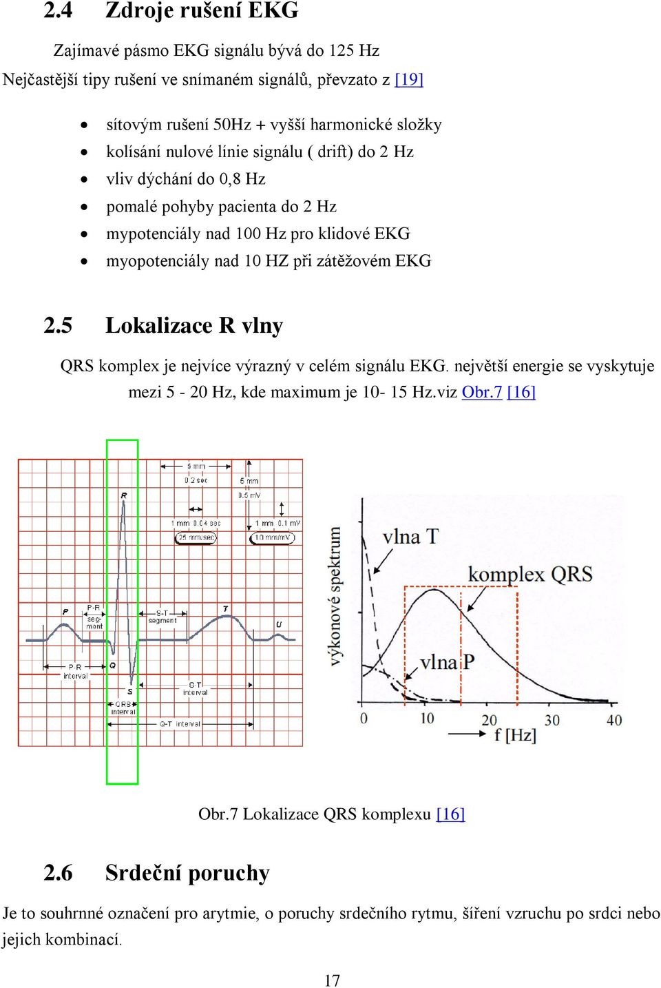 HZ při zátěžovém EKG 2.5 Lokalizace R vlny QRS komplex je nejvíce výrazný v celém signálu EKG. největší energie se vyskytuje mezi 5-20 Hz, kde maximum je 10-15 Hz.