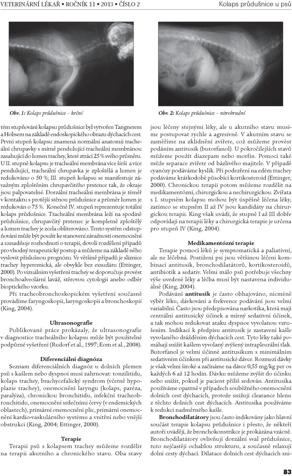 stupnì kolapsu je tracheální membrána více širší a více pendulující, tracheální chrupavka je zploštìlá a lumen je redukováno o 50 %; III.