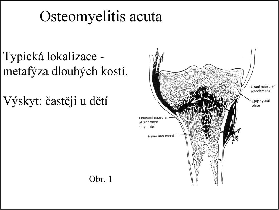 metafýza dlouhých kostí.