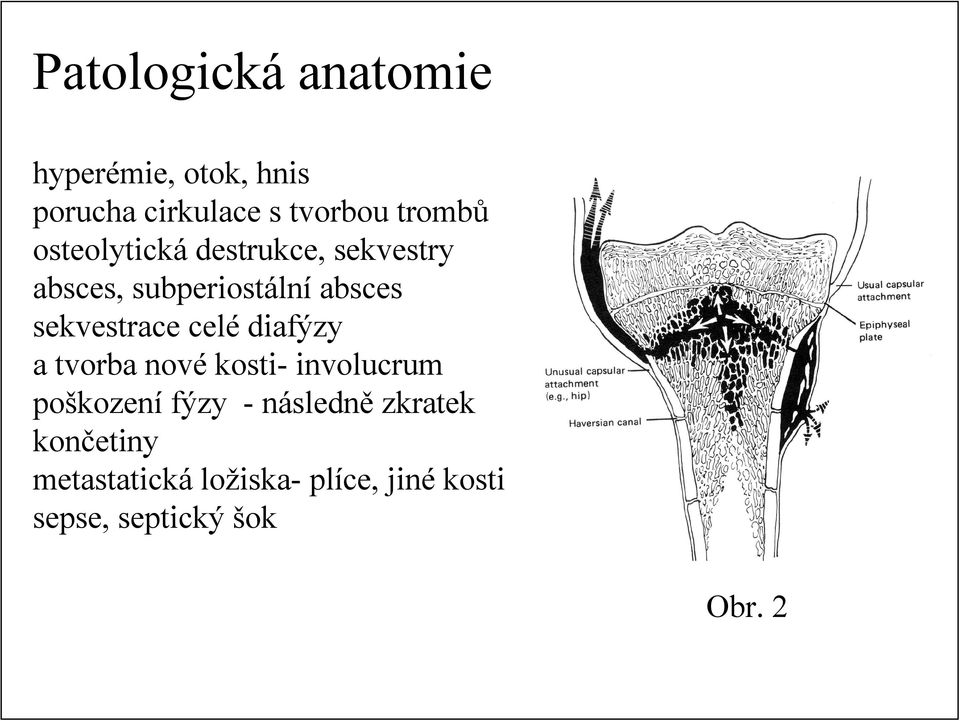 celé diafýzy a tvorba nové kosti- involucrum poškození fýzy - následně