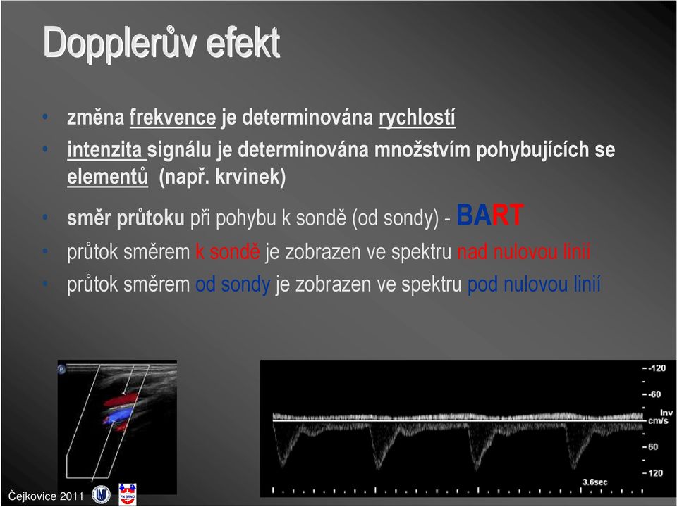 krvinek) směr průtoku při pohybu k sondě (od sondy) - BART průtok směrem k sondě