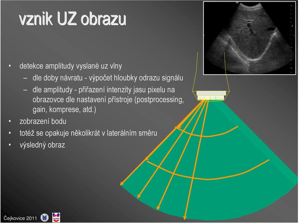 pixelu na obrazovce dle nastavení přístroje (postprocessing, gain,