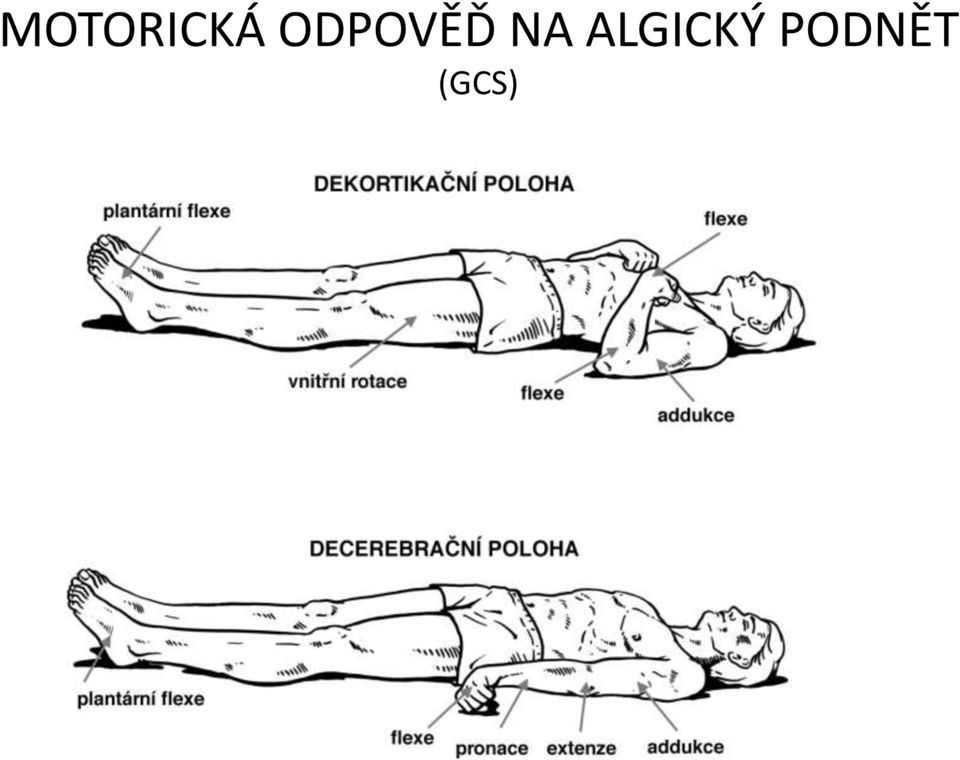 ALGICKÝ