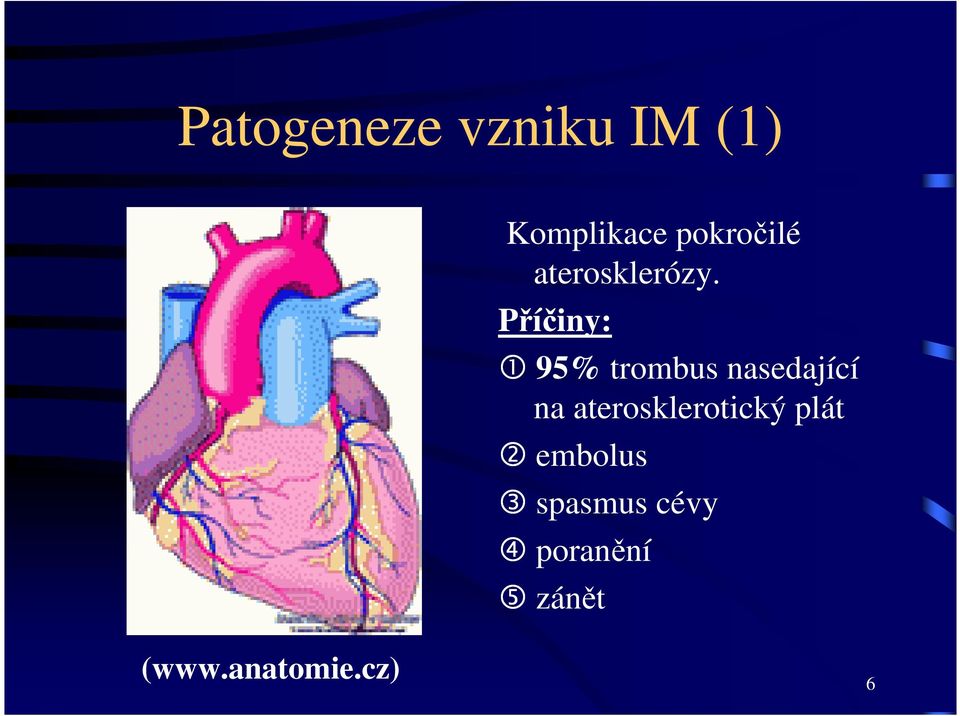 Příčiny: 1 95% trombus nasedající na