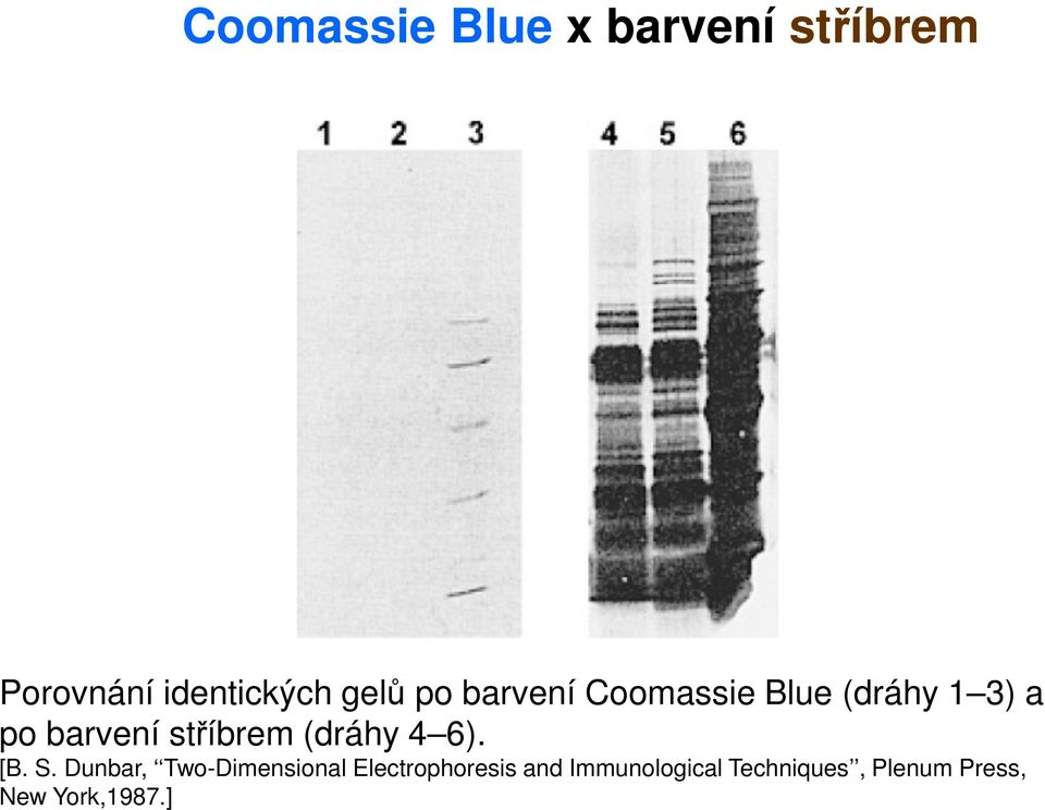 stříbrem (dráhy 4 6). [B. S.