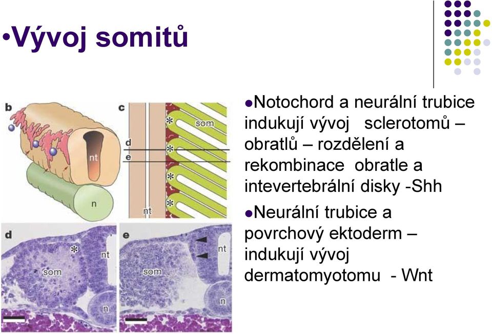 obratle a intevertebrální disky -Shh Neurální