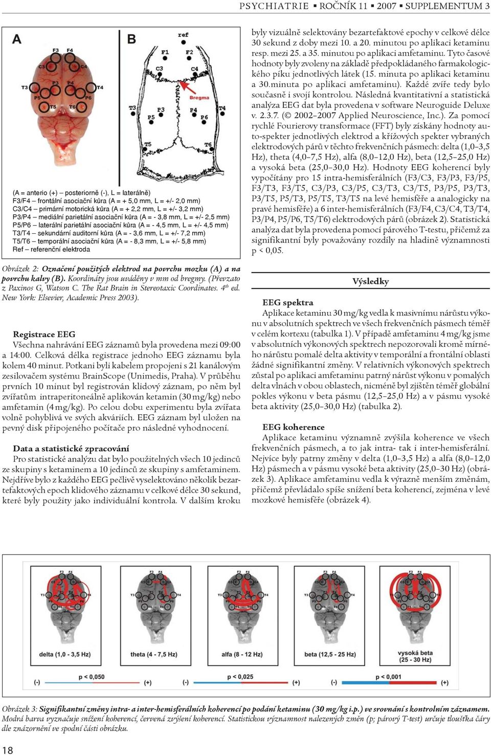 asociační kůra (A = - 8,3 mm, L = +/- 5,8 mm) Ref referenční elektroda Obrázek 2: Oznaèení použitých elektrod na povrchu mozku (A) a na povrchu kalvy (B). Koordináty jsou uvádìny v mm od bregmy.
