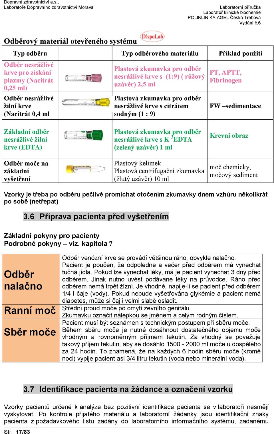 nesrážlivé žilní krve (EDTA) Odběr moče na základní vyšetření Plastová zkumavka pro odběr nesrážlivé krve s K 3 EDTA (zelený uzávěr) 1 ml Plastový kelímek Plastová centrifugační zkumavka (žlutý