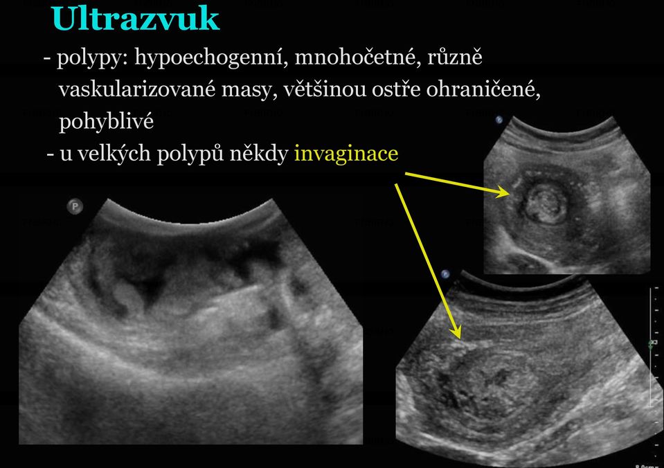 masy, většinou ostře ohraničené,