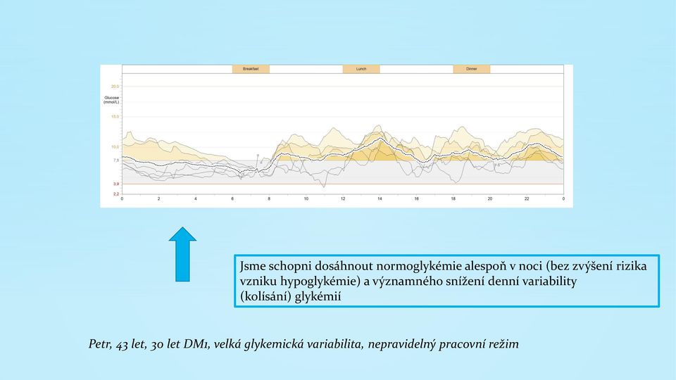 denní variability (kolísání) glykémií Petr, 43 let, 30 let