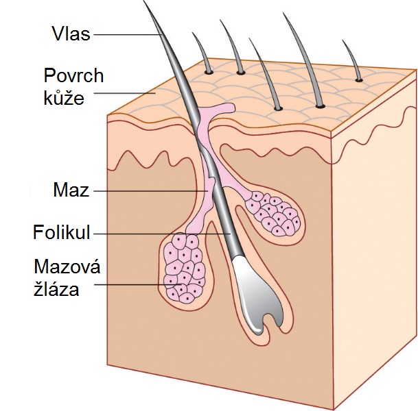 2.3 Lokalizace Aknózní proces probíhá v tzv. pilosebaceózních jednotkách. Pilosebaceózní jednotka je komplex vlasového folikulu s mazovou žlázou.