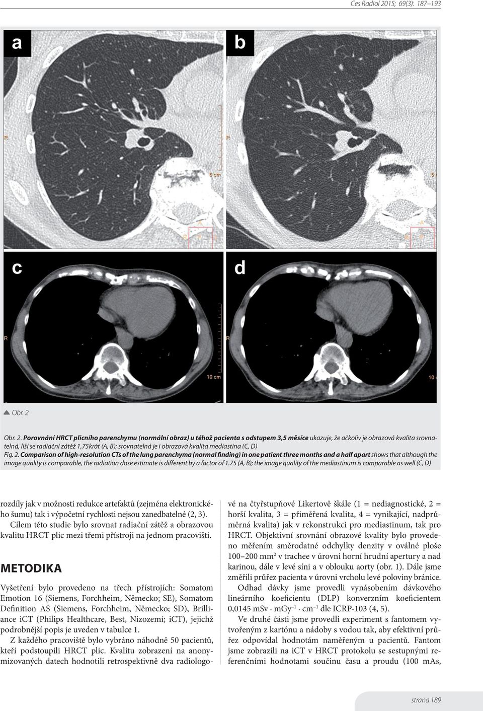 Porovnání HRCT plicního parenchymu (normální obraz) u téhož pacienta s odstupem 3,5 měsíce ukazuje, že ačkoliv je obrazová kvalita srovnatelná, liší se radiační zátěž 1,75krát (A, B); srovnatelná je