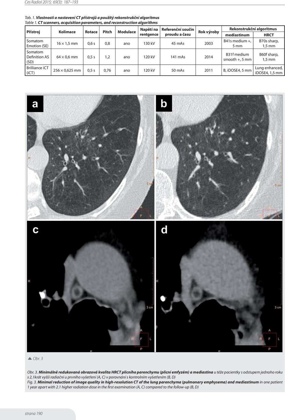 Referenční součin proudu a času Rok výroby 16 1,5 mm 0,6 s 0,8 ano 130 kv 45 mas 2003 64 0,6 mm 0,5 s 1,2 ano 120 kv 141 mas 2014 Rekonstrukční algoritmus mediastinum HRCT B41s medium +, 5 mm B31f