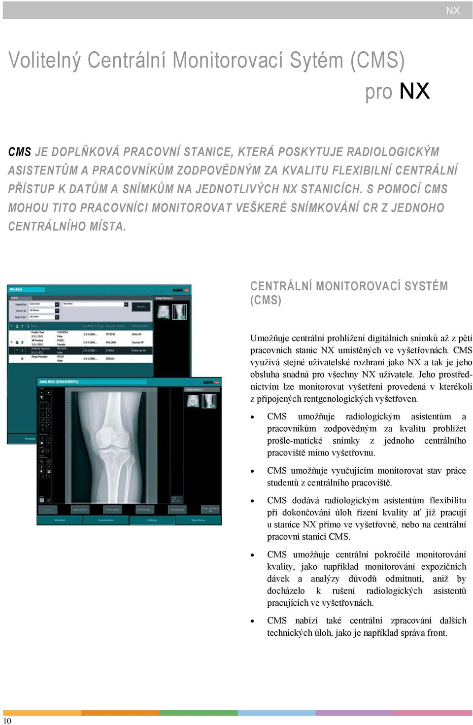 CENTRÁLNÍ MONITOROVACÍ SYSTÉM (CMS) Umožňuje centrální prohlížení digitálních snímků až z pěti pracovních stanic NX umístěných ve vyšetřovnách.